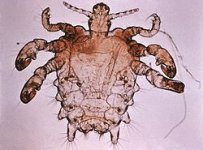 crab_louse.jpg